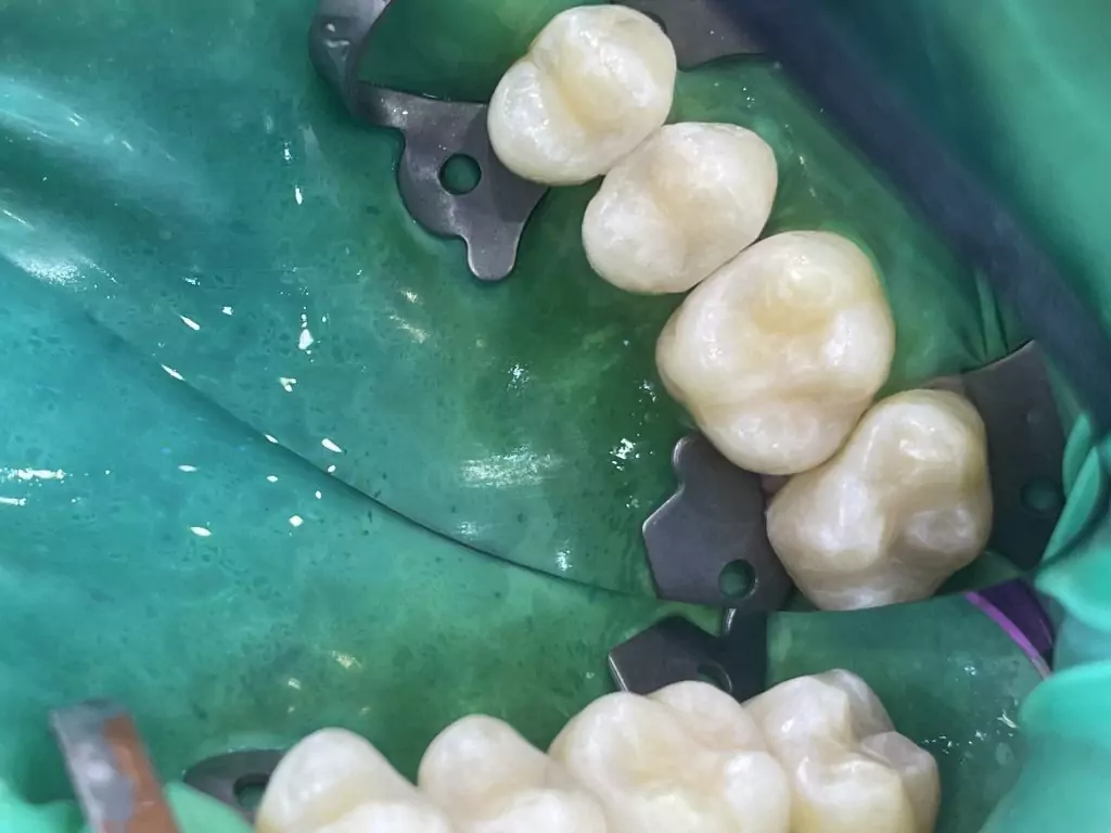 Prophylactics